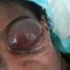 Guanambi: na regulação, mulher aguarda há quase 30 dias vaga com oncologista em Vitória da Conquista.