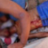 Jovem é atingido a tiros em Guanambi.