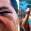 Rio do Ant?nio: Vereador ? agredido por secret?ria de administra??o.