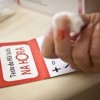 Mais 300 pessoas foram diagnosticas com HIV/Aids em Guanambi.