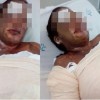 Confus?o em tri?ngulo amoroso: esposa joga ?cido no amante do marido, que revida jogando ?cido na esposa.