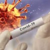 Bahia confirma 18 casos de Covid-19; Salvador soma 9 ocorrências.