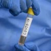 Covid-19: Bahia registra 462 casos, 14 óbitos e 106 pessoas curadas.