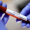 Mais seis casos de covid-19 são confirmados em Iuiú.