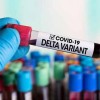 Vitória da Conquista identificou um caso da variante delta.