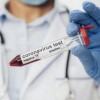 Bahia registra 13 casos de Covid-19 e mais 2 óbitos.