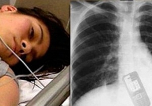Jovem engole celular para namorado não ler mensagens.