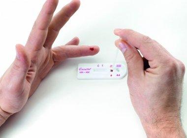 Autoteste para detecção do HIV estará disponível nas farmácias este ano.