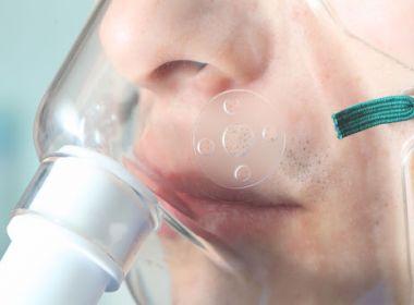 CFM classifica nebulização com cloroquina como experimental e sugere mais pesquisas.