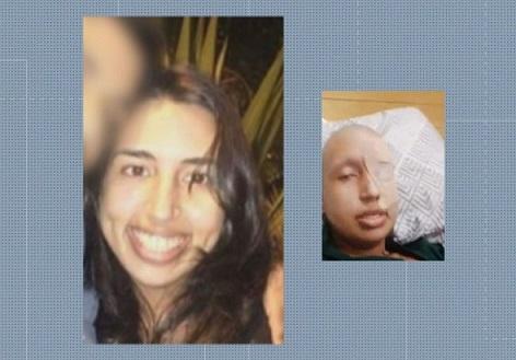 Polícia investiga se mulher forjou câncer e até raspou a cabeça por doações que somam R$ 50 mil.
