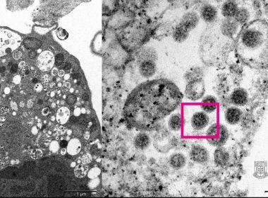 Ômicron é variante que sobrevive por mais tempo na pele e em plásticos, mostra estudo.