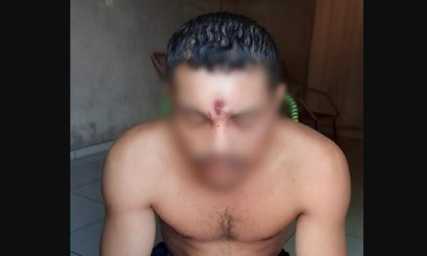 Homem leva tiro na testa, cai de moto e vai para casa dormir: neurocirurgião explica como isso é possível.