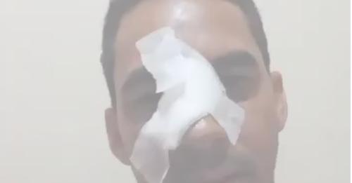 Homem que teve faca cravada no rosto em Carinhanha passa por cirurgia.