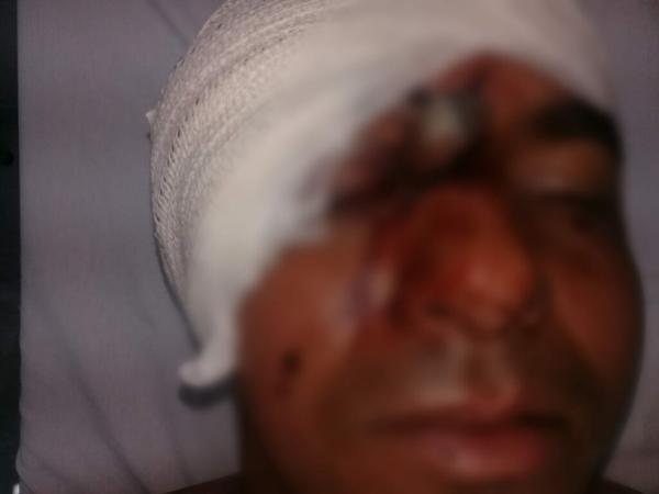 Homem tem faca cravada no rosto após briga com irmão e é levado para Hospital geral de Guanambi.