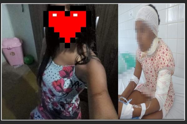 Polícia prende mulher por suspeita de atear fogo em outra.