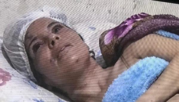 Mulher sobrevive após ser espancada, estrangulada e enterrada viva pelo ex-companheiro na Bahia. Mulher sobrevive após ser espancada, estrangulada e enterrada viva pelo ex-companheiro na Bahia.