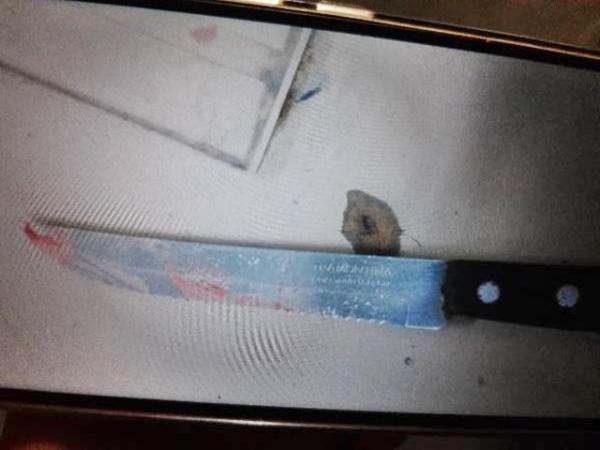 Mulher é suspeita de esfaquear companheiro durante a madrugada.