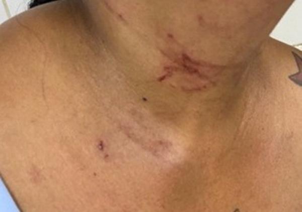 Mulher fica ferida após discussão com companheiro em Guanambi.