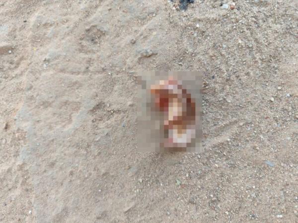 Homem é esfaqueado, volta armado com facão e corta orelha de agressor em Caculé.