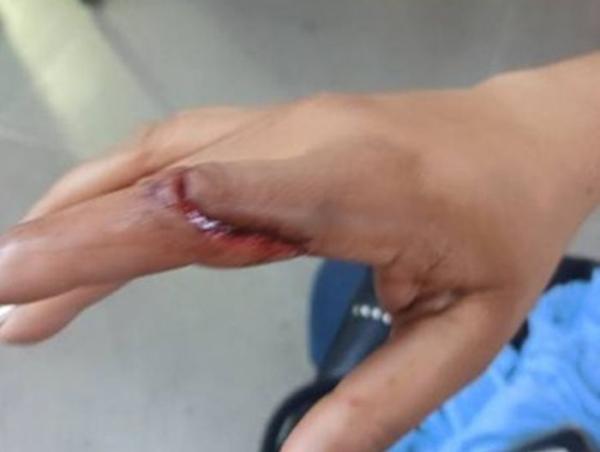 Mulher fica ferida durante ocorrência de violência doméstica na zona rural de Pindaí.